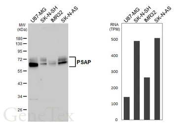 Anti-PSAP antibody [HL6003] used in Western Blot (WB). GTX648077
