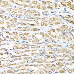 Anti-IKAP antibody used in IHC (Paraffin sections) (IHC-P). GTX64808