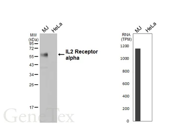 Anti-IL2 Receptor alpha antibody [HL6029] used in Western Blot (WB). GTX648103