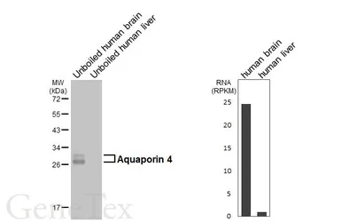 Anti-Aquaporin 4 antibody [HL6037] used in Western Blot (WB). GTX648111