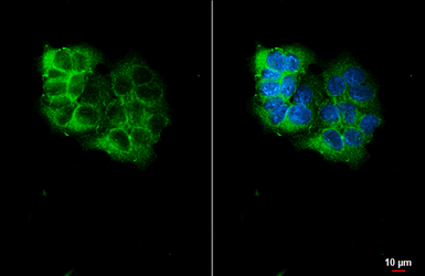 Anti-Nectin 2 antibody [HL6045] used in Immunocytochemistry/ Immunofluorescence (ICC/IF). GTX648124