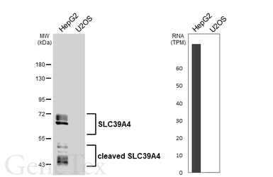 Anti-SLC39A4 antibody [HL6051] used in Western Blot (WB). GTX648130