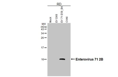 Anti-Enterovirus 71 2B antibody [HL6053] used in Western Blot (WB). GTX648132