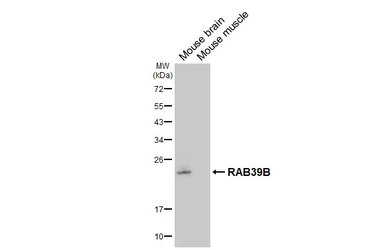 Anti-RAB39B antibody [HL6060] used in Western Blot (WB). GTX648139