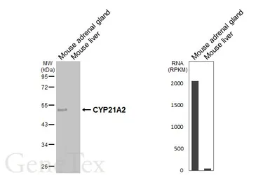 Anti-CYP21A2 antibody [HL6072] used in Western Blot (WB). GTX648151