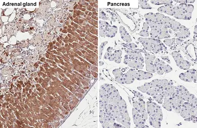 Anti-CYP21A2 antibody [HL6072] used in IHC (Paraffin sections) (IHC-P). GTX648151