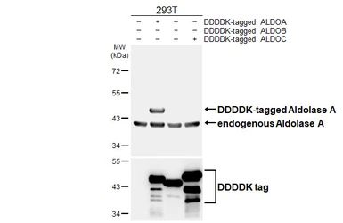Anti-Aldolase A antibody [HL6080] used in Western Blot (WB). GTX648159