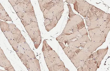 Anti-Aldolase A antibody [HL6080] used in IHC (Paraffin sections) (IHC-P). GTX648159