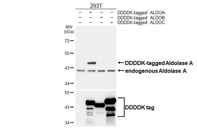 Anti-Aldolase A antibody [HL6082] used in Western Blot (WB). GTX648161