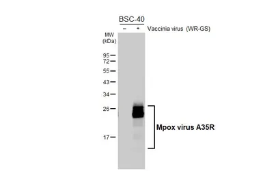 Anti-Mpox virus A35R antibody [GT402] used in Western Blot (WB). GTX648167