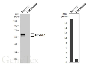 Anti-ACVRL1 antibody [HL6091] used in Western Blot (WB). GTX648176