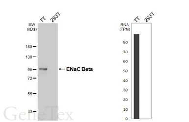 Anti-ENaC Beta antibody [HL6092] used in Western Blot (WB). GTX648177