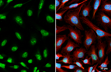 Anti-c-Myc antibody [HL6095] used in Immunocytochemistry/ Immunofluorescence (ICC/IF). GTX648180