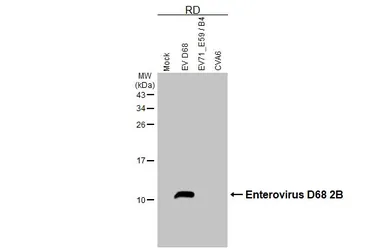 Anti-Enterovirus D68 2B antibody [HL6099] used in Western Blot (WB). GTX648184