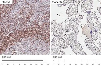 Anti-CD3 epsilon antibody [HL6121] used in IHC (Paraffin sections) (IHC-P). GTX648206