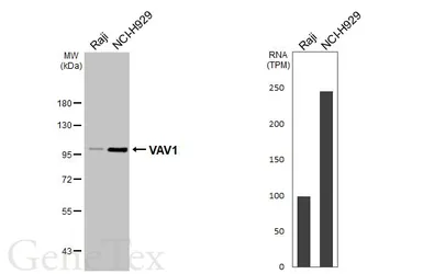 Anti-VAV1 antibody [HL6129] used in Western Blot (WB). GTX648214