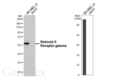 Anti-Retinoid X Receptor gamma antibody [HL6140] used in Western Blot (WB). GTX648227