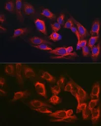 Anti-MYO10 antibody used in Immunocytochemistry/ Immunofluorescence (ICC/IF). GTX64824