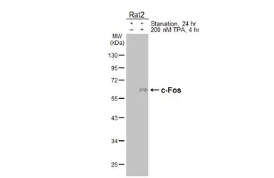 Anti-c-Fos antibody [HL6157] used in Western Blot (WB). GTX648244
