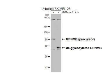 Anti-GPNMB antibody [HL6170] used in Western Blot (WB). GTX648257