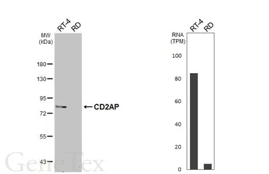 Anti-CD2AP antibody [HL6173] used in Western Blot (WB). GTX648260