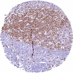 Anti-Rad51 antibody [HMV4727] HistoMAX&trade; used in IHC (Paraffin sections) (IHC-P). GTX648264