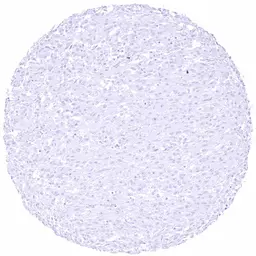 Anti-Claudin 18.2 antibody [HMV4729] HistoMAX&trade; used in IHC (Paraffin sections) (IHC-P). GTX648266