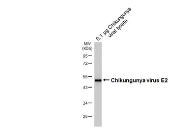 Anti-Chikungunya virus E2 antibody [HL6185] used in Western Blot (WB). GTX648277