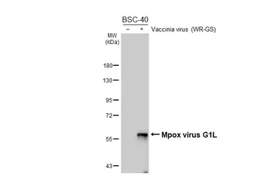 Anti-Mpox virus G1L antibody [HL6196] used in Western Blot (WB). GTX648288
