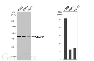 Anti-CD2AP antibody [HL6216] used in Western Blot (WB). GTX648308