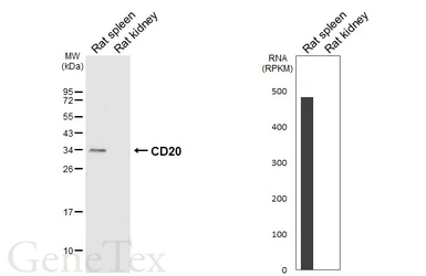 Anti-CD20 antibody [HL6217] used in Western Blot (WB). GTX648309