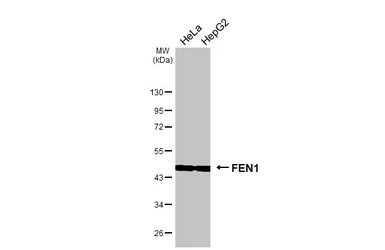 Anti-FEN1 antibody [HL6225] used in Western Blot (WB). GTX648317