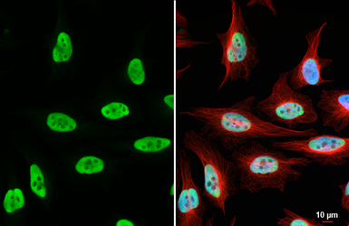 Anti-FEN1 antibody [HL6225] used in Immunocytochemistry/ Immunofluorescence (ICC/IF). GTX648317