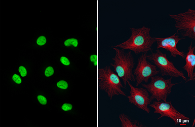 Anti-FEN1 antibody [HL6226] used in Immunocytochemistry/ Immunofluorescence (ICC/IF). GTX648318