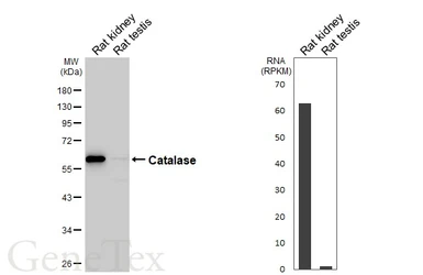 Anti-Catalase antibody [HL6227] used in Western Blot (WB). GTX648319