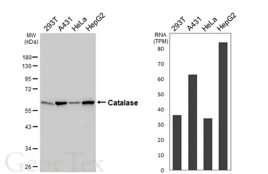 Anti-Catalase antibody [HL6227] used in Western Blot (WB). GTX648319