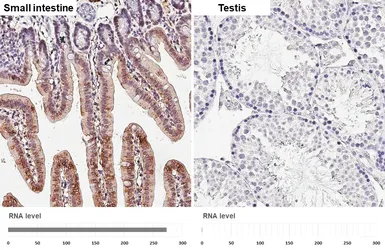 Anti-Aldolase B antibody [HL6236] used in IHC (Paraffin sections) (IHC-P). GTX648328