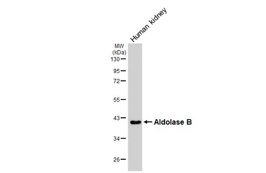 Anti-Aldolase B antibody [HL6236] used in Western Blot (WB). GTX648328