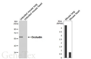 Anti-Occludin antibody [HL6239] used in Western Blot (WB). GTX648331