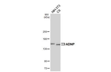 Anti-ADNP antibody [HL6241] used in Western Blot (WB). GTX648333