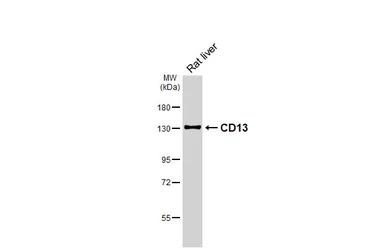 Anti-CD13 antibody [HL6252] used in Western Blot (WB). GTX648344