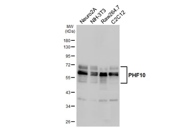 Anti-PHF10 antibody [HL6286] used in Western Blot (WB). GTX648388