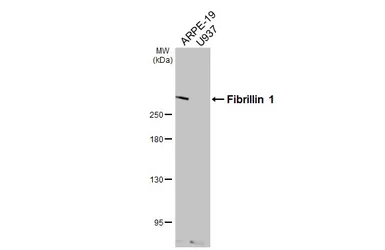 Anti-Fibrillin 1 antibody [HL6290] used in Western Blot (WB). GTX648392