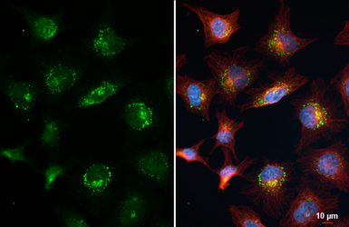 Anti-AXIN1 antibody [HL6295] used in Immunocytochemistry/ Immunofluorescence (ICC/IF). GTX648397