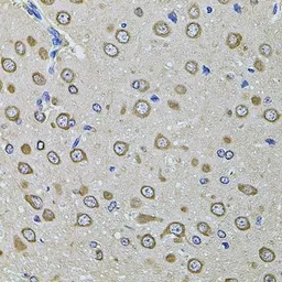 Anti-EIF4A2 antibody used in IHC (Paraffin sections) (IHC-P). GTX64840