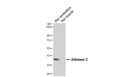 Anti-Aldolase C antibody [HL6306] used in Western Blot (WB). GTX648408