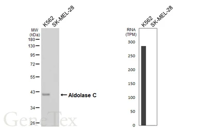 Anti-Aldolase C antibody [HL6306] used in Western Blot (WB). GTX648408