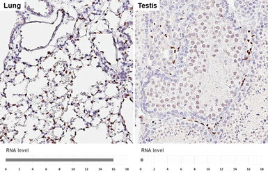 Anti-ERG antibody [HL6309] used in IHC (Paraffin sections) (IHC-P). GTX648411