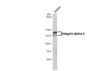 Anti-Integrin alpha 4 antibody [HL6340] used in Western Blot (WB). GTX648450