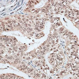 Anti-RBM17 antibody used in IHC (Paraffin sections) (IHC-P). GTX64861